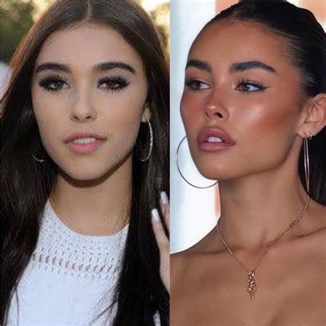 madison beer plastic sugery|Madison Beer Has Addressed Plastic Surgery Rumors。